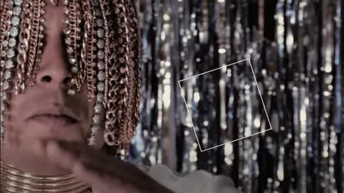 Un rappeur mexicain se fait implanter des chaînes en or sur la tête...